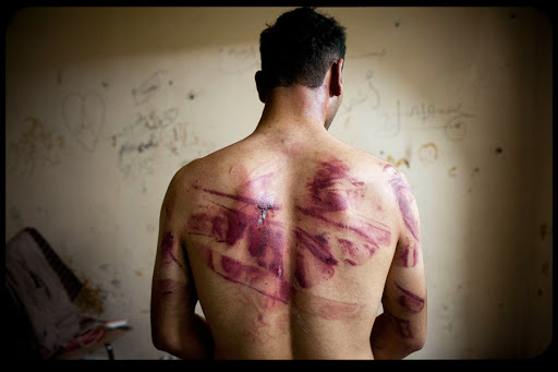 WEB Syrian Torture 001 &#8211; fr