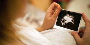 Trisomie 21 : les chiffres effarants du diagnostic prénatal